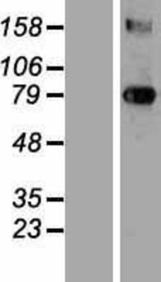 Western Blot: Transglutaminase 3 Overexpression Lysate (Adult Normal) [NBP2-10879] Left-Empty vector transfected control cell lysate (HEK293 cell lysate); Right -Over-expression Lysate for Transglutaminase 3.