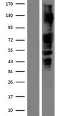 Western Blot: PAK1 Overexpression Lysate (Adult Normal) [NBP2-09482] Left-Empty vector transfected control cell lysate (HEK293 cell lysate); Right -Over-expression Lysate for PAK1.