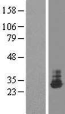 Western Blot: THTPA Overexpression Lysate (Adult Normal) [NBP2-09424] Left-Empty vector transfected control cell lysate (HEK293 cell lysate); Right -Over-expression Lysate for THTPA.