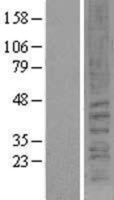 Western Blot: Cannabinoid Receptor II Overexpression Lysate (Adult Normal) [NBL1-09328] Left-Empty vector transfected control cell lysate (HEK293 cell lysate); Right -Over-expression Lysate for Cannabinoid Receptor II.