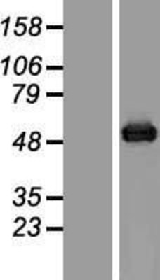 Western Blot: Aspartate beta hydroxylase Overexpression Lysate (Adult Normal) [NBP2-06020] Left-Empty vector transfected control cell lysate (HEK293 cell lysate); Right -Over-expression Lysate for Aspartate beta hydroxylase.