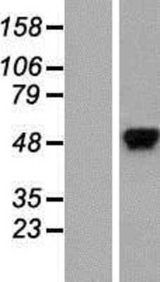 Western Blot: hnRNP K Overexpression Lysate (Adult Normal) [NBP2-06147] Left-Empty vector transfected control cell lysate (HEK293 cell lysate); Right -Over-expression Lysate for hnRNP K.