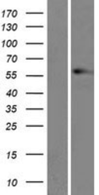 Western Blot: Vimentin Overexpression Lysate (Adult Normal) [NBP2-04249] Left-Empty vector transfected control cell lysate (HEK293 cell lysate); Right -Over-expression Lysate for Vimentin.