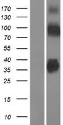 Western Blot: SLC30A8/ZNT8 Overexpression Lysate (Adult Normal) [NBP2-05081] Left-Empty vector transfected control cell lysate (HEK293 cell lysate); Right -Over-expression Lysate for SLC30A8/ZNT8.