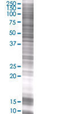 SLC7A1 transfected lysate.
