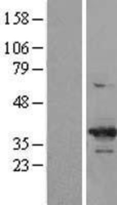 Western Blot: Cdk6 Overexpression Lysate (Adult Normal) [NBP2-09735] Left-Empty vector transfected control cell lysate (HEK293 cell lysate); Right -Over-expression Lysate for Cdk6.