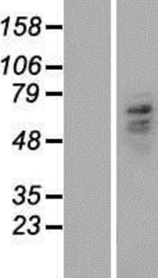 Western Blot: Carboxypeptidase M Overexpression Lysate (Adult Normal) [NBP2-10755] Left-Empty vector transfected control cell lysate (HEK293 cell lysate); Right -Over-expression Lysate for Carboxypeptidase M.