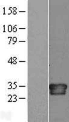 Western Blot: Interleukin 34 Overexpression Lysate (Adult Normal) [NBL1-11955] Left-Empty vector transfected control cell lysate (HEK293 cell lysate); Right -Over-expression Lysate for Interleukin 34.