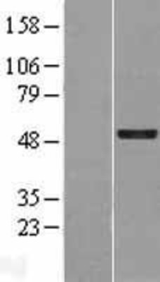 Western Blot: GFI1 Overexpression Lysate (Adult Normal) [NBP2-09431] Left-Empty vector transfected control cell lysate (HEK293 cell lysate); Right -Over-expression Lysate for GFI1.