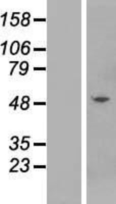 Western Blot: KRTHB3 Overexpression Lysate (Adult Normal) [NBP2-10817] Left-Empty vector transfected control cell lysate (HEK293 cell lysate); Right -Over-expression Lysate for KRTHB3.