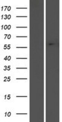 Western Blot: Adenylate Cyclase 7 Overexpression Lysate (Adult Normal) [NBP2-10952] Left-Empty vector transfected control cell lysate (HEK293 cell lysate); Right -Over-expression Lysate for Adenylate Cyclase 7.