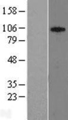 Western Blot: SUV420h1 Overexpression Lysate (Adult Normal) [NBL1-16627] Left-Empty vector transfected control cell lysate (HEK293 cell lysate); Right -Over-expression Lysate for SUV420h1.