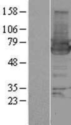 Western Blot: HIP-55 Overexpression Lysate (Adult Normal) [NBP2-11007] Left-Empty vector transfected control cell lysate (HEK293 cell lysate); Right -Over-expression Lysate for HIP-55.