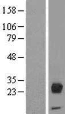 Western Blot: Orosomucoid 2 Overexpression Lysate (Adult Normal) [NBP2-10686] Left-Empty vector transfected control cell lysate (HEK293 cell lysate); Right -Over-expression Lysate for Orosomucoid 2.