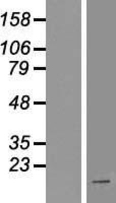 Western Blot: HOXA1 Overexpression Lysate (Adult Normal) [NBP2-05236] Left-Empty vector transfected control cell lysate (HEK293 cell lysate); Right -Over-expression Lysate for HOXA1.
