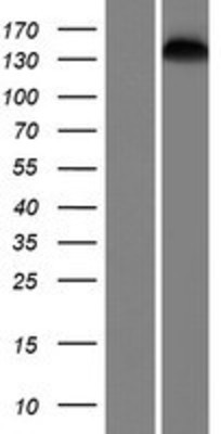 Western Blot: SMC1L2 Overexpression Lysate (Adult Normal) [NBP2-05427] Left-Empty vector transfected control cell lysate (HEK293 cell lysate); Right -Over-expression Lysate for SMC1L2.