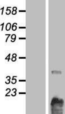 Western Blot: CHKL Overexpression Lysate (Adult Normal) [NBP2-05413] Left-Empty vector transfected control cell lysate (HEK293 cell lysate); Right -Over-expression Lysate for CHKL.