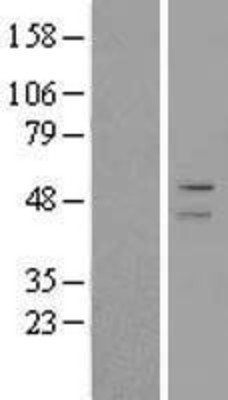 Western Blot: ADFP Overexpression Lysate (Adult Normal) [NBL1-07334] Left-Empty vector transfected control cell lysate (HEK293 cell lysate); Right -Over-expression Lysate for ADFP.