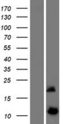 Western Blot: DYNLRB2 Overexpression Lysate (Adult Normal) [NBP2-05721] Left-Empty vector transfected control cell lysate (HEK293 cell lysate); Right -Over-expression Lysate for DYNLRB2.