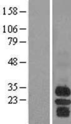 Western Blot: BAFF Receptor Overexpression Lysate (Adult Normal) [NBL1-17149] Left-Empty vector transfected control cell lysate (HEK293 cell lysate); Right -Over-expression Lysate for BAFF Receptor.