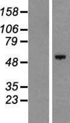Western Blot: C17orf66 Overexpression Lysate (Adult Normal) [NBP2-05307] Left-Empty vector transfected control cell lysate (HEK293 cell lysate); Right -Over-expression Lysate for C17orf66.