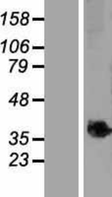 Western Blot: C9orf91 Overexpression Lysate (Adult Normal) [NBP2-05250] Left-Empty vector transfected control cell lysate (HEK293 cell lysate); Right -Over-expression Lysate for C9orf91.