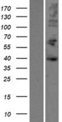 Western Blot: AUF1 Overexpression Lysate (Adult Normal) [NBP2-09923] Left-Empty vector transfected control cell lysate (HEK293 cell lysate); Right -Over-expression Lysate for AUF1.