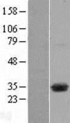 Western Blot: DHRSX Overexpression Lysate (Adult Normal) [NBP2-05502] Left-Empty vector transfected control cell lysate (HEK293 cell lysate); Right -Over-expression Lysate for DHRSX.