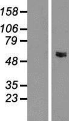 Western Blot: GLYCTK Overexpression Lysate (Adult Normal) [NBP2-05491] Left-Empty vector transfected control cell lysate (HEK293 cell lysate); Right -Over-expression Lysate for GLYCTK.