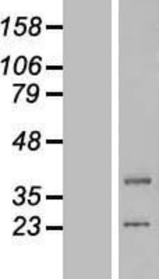 Western Blot: lipoyltransferase 1 Overexpression Lysate (Adult Normal) [NBP2-05506] Left-Empty vector transfected control cell lysate (HEK293 cell lysate); Right -Over-expression Lysate for lipoyltransferase 1.