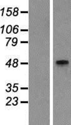 Western Blot: GCNT2 Overexpression Lysate (Adult Normal) [NBP2-05479] Left-Empty vector transfected control cell lysate (HEK293 cell lysate); Right -Over-expression Lysate for GCNT2.