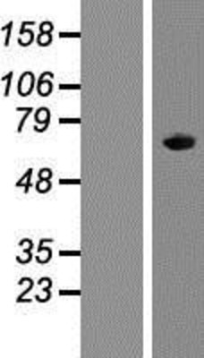 Western Blot: APOBEC1 Overexpression Lysate (Adult Normal) [NBP2-05621] Left-Empty vector transfected control cell lysate (HEK293 cell lysate); Right -Over-expression Lysate for APOBEC1.