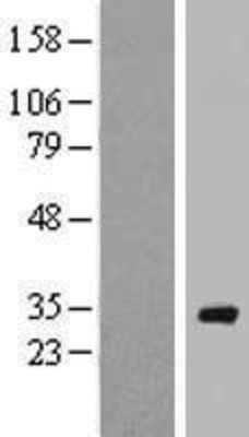 Western Blot: RAB40A Overexpression Lysate (Adult Normal) [NBP2-05749] Left-Empty vector transfected control cell lysate (HEK293 cell lysate); Right -Over-expression Lysate for RAB40A.