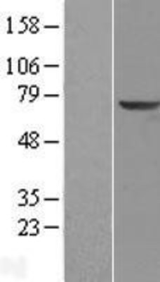 Western Blot: KLHL2 Overexpression Lysate (Adult Normal) [NBL1-12335] Left-Empty vector transfected control cell lysate (HEK293 cell lysate); Right -Over-expression Lysate for KLHL2.