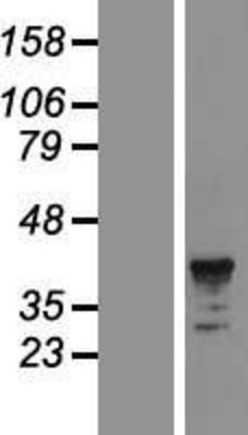 Western Blot: CD89 Overexpression Lysate (Adult Normal) [NBP2-05715] Left-Empty vector transfected control cell lysate (HEK293 cell lysate); Right -Over-expression Lysate for CD89.
