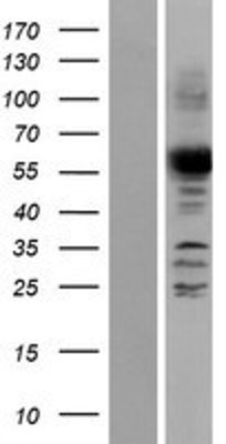 Western Blot: ANGEL2 Overexpression Lysate (Adult Normal) [NBP2-05558] Left-Empty vector transfected control cell lysate (HEK293 cell lysate); Right -Over-expression Lysate for ANGEL2.