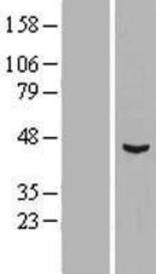 Western Blot: Spred-1 Overexpression Lysate (Adult Normal) [NBP2-05326] Left-Empty vector transfected control cell lysate (HEK293 cell lysate); Right -Over-expression Lysate for Spred-1.