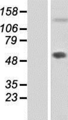 Western Blot: TM14 Overexpression Lysate (Adult Normal) [NBP2-05274] Left-Empty vector transfected control cell lysate (HEK293 cell lysate); Right -Over-expression Lysate for TM14.