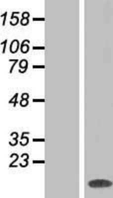 Western Blot: MAX Overexpression Lysate (Adult Normal) [NBP2-05496] Left-Empty vector transfected control cell lysate (HEK293 cell lysate); Right -Over-expression Lysate for MAX.