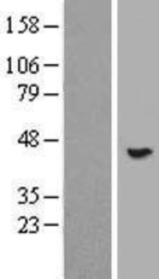 Western Blot: FLJ23356 Overexpression Lysate (Adult Normal) [NBP2-06056] Left-Empty vector transfected control cell lysate (HEK293 cell lysate); Right -Over-expression Lysate for FLJ23356.
