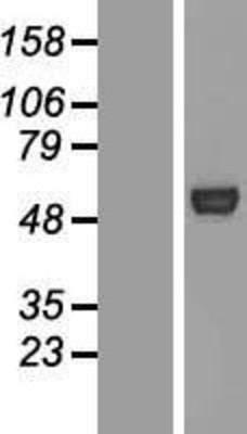Western Blot: ATG4C Overexpression Lysate (Adult Normal) [NBP2-05958] Left-Empty vector transfected control cell lysate (HEK293 cell lysate); Right -Over-expression Lysate for ATG4C.