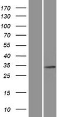 Western Blot: Shugoshin Overexpression Lysate (Adult Normal) [NBP2-05650] Left-Empty vector transfected control cell lysate (HEK293 cell lysate); Right -Over-expression Lysate for Shugoshin.