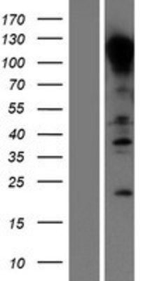 Western Blot: E-Cadherin Overexpression Lysate (Adult Normal) [NBL1-09024] Left-Empty vector transfected control cell lysate (HEK293 cell lysate); Right -Over-expression Lysate for E-Cadherin.