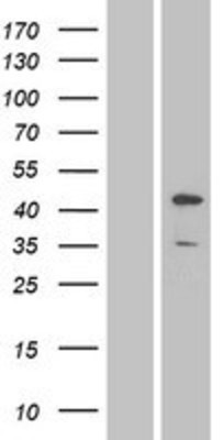 Western Blot: JNK1 Overexpression Lysate (Adult Normal) [NBP2-05602] Left-Empty vector transfected control cell lysate (HEK293 cell lysate); Right -Over-expression Lysate for JNK1.