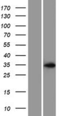 Western Blot: ASB17 Overexpression Lysate (Adult Normal) [NBP2-05755] Left-Empty vector transfected control cell lysate (HEK293 cell lysate); Right -Over-expression Lysate for ASB17.
