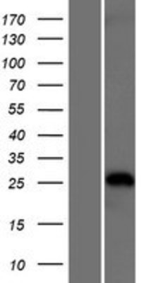 Western Blot: TRIM40 Overexpression Lysate (Adult Normal) [NBP2-05640] Left-Empty vector transfected control cell lysate (HEK293 cell lysate); Right -Over-expression Lysate for TRIM40.