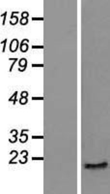 Western Blot: Skp1 Overexpression Lysate (Adult Normal) [NBP2-09837] Left-Empty vector transfected control cell lysate (HEK293 cell lysate); Right -Over-expression Lysate for Skp1.