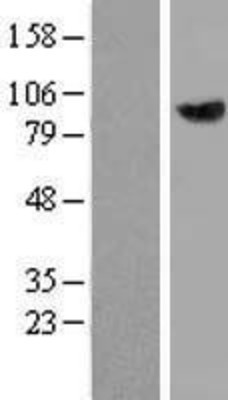 Western Blot: OIP106 Overexpression Lysate (Adult Normal) [NBL1-17251] Left-Empty vector transfected control cell lysate (HEK293 cell lysate); Right -Over-expression Lysate for OIP106.
