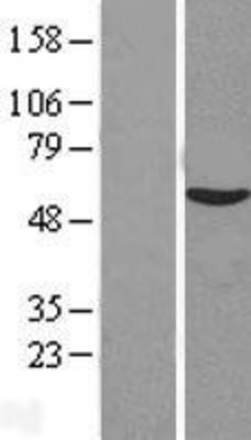 Western Blot: VIPAR Overexpression Lysate (Adult Normal) [NBL1-08175] Left-Empty vector transfected control cell lysate (HEK293 cell lysate); Right -Over-expression Lysate for VIPAR.