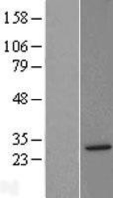 Western Blot: Syntaxin-8 Overexpression Lysate (Adult Normal) [NBL1-16586] Left-Empty vector transfected control cell lysate (HEK293 cell lysate); Right -Over-expression Lysate for Syntaxin-8.